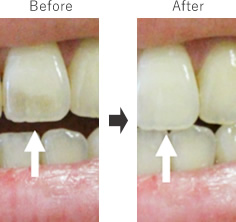 Before After