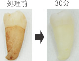 処理前-30分後