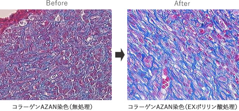 コラーゲン増産・再生促進機能によるアンチエイジング